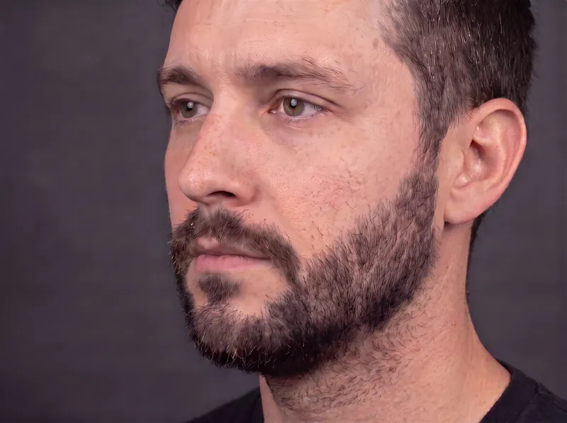 After beard SMP: full, defined beard line